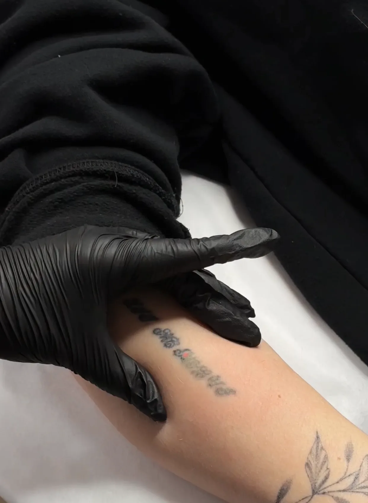 Laserowe usuwanie tatuażu – KATARZYNA BRUI Salon urody Białystok – efekt zabiegu